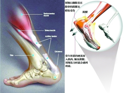 各种运动员职业生涯中的常见选择与难题